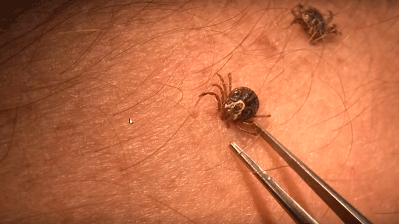 important facts about ticks - tweezing-tick