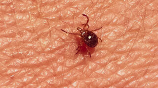 Best Products To Keep Ticks Off Your Body