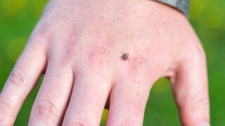 Over Half Of Wisconsin Deer Ticks Carry Lyme Disease